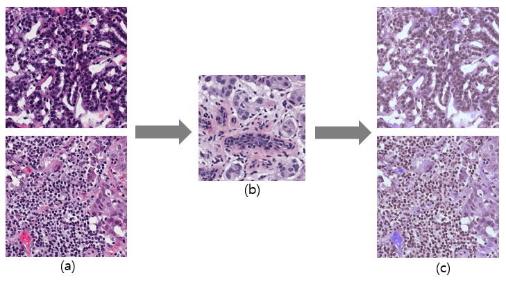 Stain Normalization